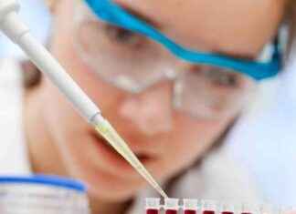 Alzheimer Hastalığı İlerlemesini ve Şiddetini İzlemeye Yardımcı Olan Kan Testi alzheimer-hastal-ilerlemesini-ve-iddetini-izlemeye-yardmc-olan-kan-testi