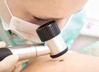 EpCAM’ın erken evre hepatosellüler karsinom ilerlemesindeki rolü epcamn-erken-evre-hepatoselller-karsinom-ilerlemesindeki-rol