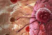 Genetik Testlerle Kanser Riski Belirleme ve Potansiyel Tehlikeler genetik-testlerle-kanser-riski-belirleme-ve-potansiyel-tehlikeler