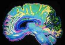 Gençlerde Sağlıksız Beslenme Alışkanlıkları ile İlişkili Beyin Olgunlaşma Gecikmeleri genlerde-salksz-beslenme-alkanlklar-ile-ilikili-beyin-olgunlama-gecikmeleri