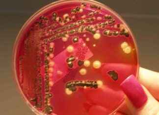 Hava Koşullarının Salmonella Bulaşımı Üzerindeki Etkisi Araştırıldı hava-koullarnn-salmonella-bulam-zerindeki-etkisi-aratrld