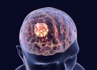 Melanom Hastalarında Beyin Tümörü Yanıtını Değerlendirmek İçin En İyi Görüntüleme Yöntemleri melanom-hastalarnda-beyin-tmr-yantn-deerlendirmek-iin-en-iyi-grntleme-yntemleri