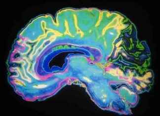 Monoamine Neurotransmitters: Beyin Fizyolojisinin Mimarı olarak Ortaya Çıkıyor monoamine-neurotransmitters-beyin-fizyolojisinin-mimar-olarak-ortaya-kyor