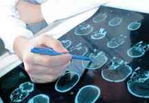 Potansiyel Epilepsi Tanısı için Biyobelirteçler Açığa Çıkarıldı potansiyel-epilepsi-tans-iin-biyobelirteler-aa-karld