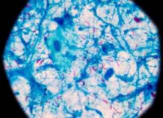 Yeni İlaç Regimenleri Dirençli Verem İçin Umut Vadeder yeni-ila-regimenleri-direnli-verem-iin-umut-vadeder