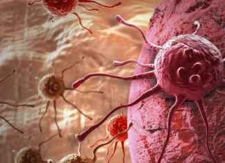 BRCA1 Mutasyonunun Prostat Kanseri Oluşumundaki Rolü Üzerine Çalışma brca1-mutasyonunun-prostat-kanseri-oluumundaki-rol-zerine-alma