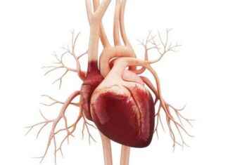 Michigan Üniversitesi’nin Yeni Kalp Pompası Klinik Denemesi michigan-niversitesinin-yeni-kalp-pompas-klinik-denemesi