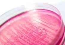 Mısır süt ürünlerinde yaygın E. coli kirliliği tespit edildi msr-st-rnlerinde-yaygn-e-coli-kirlilii-tespit-edildi