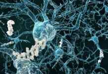 Alzheimer Hastalığının Vücuda Etkilerini Gösteren Yeni Çalışma alzheimer-hastalnn-vcuda-etkilerini-gsteren-yeni-alma