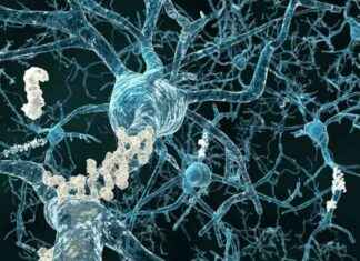 Alzheimer Hastalığının Vücuda Etkilerini Gösteren Yeni Çalışma alzheimer-hastalnn-vcuda-etkilerini-gsteren-yeni-alma