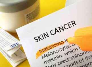 Kanada’da Güneş Kremi Kullanımı Azalırken Melanom Vakaları Artıyor kanadada-gne-kremi-kullanm-azalrken-melanom-vakalar-artyor