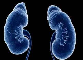 Ochsner böbrek nakli programı ulusal ELITE statüsü kazanır. ochsner-bbrek-nakli-program-ulusal-elte-stats-kazanr